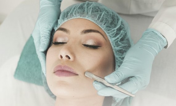 Séance de microneedling